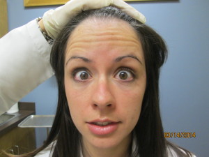 Raising eyebrows prior to Botox injections.